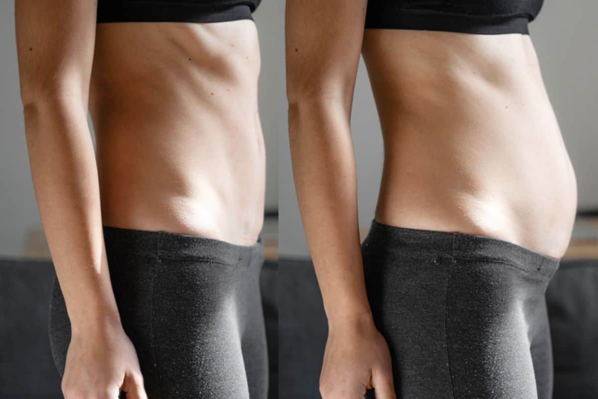 How long does diastasis recti take to improve Bradford-on-Avon?