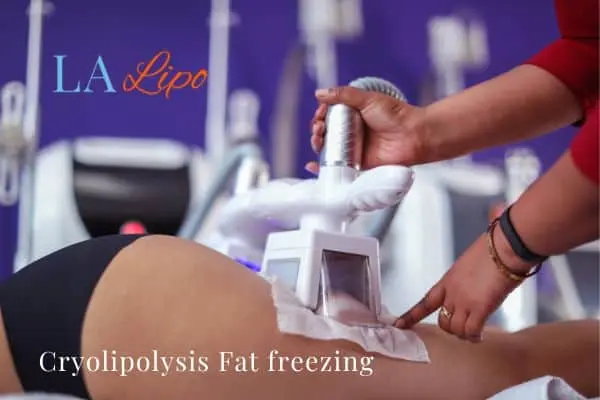 women getting fat freezing Bradford-on-Avon
