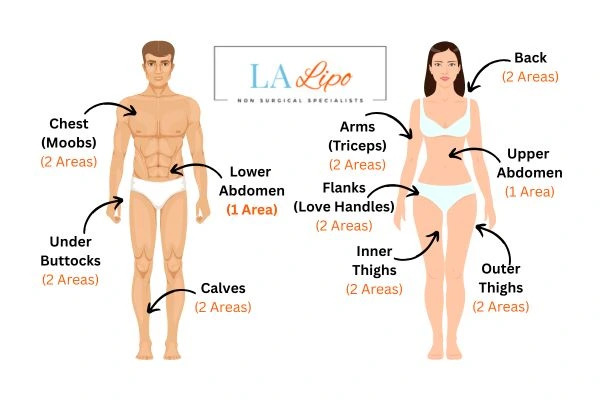 LA LIPO Cryolipolysis Areas Bradford-on-Avon