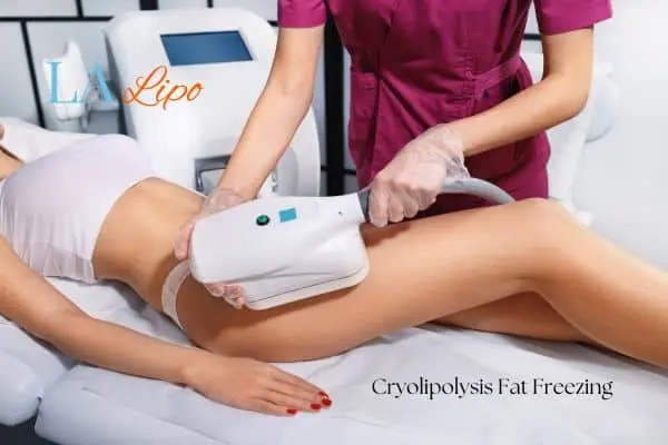 Woman receiving coolsculpting Bradford-on-Avon treatment on her thighs