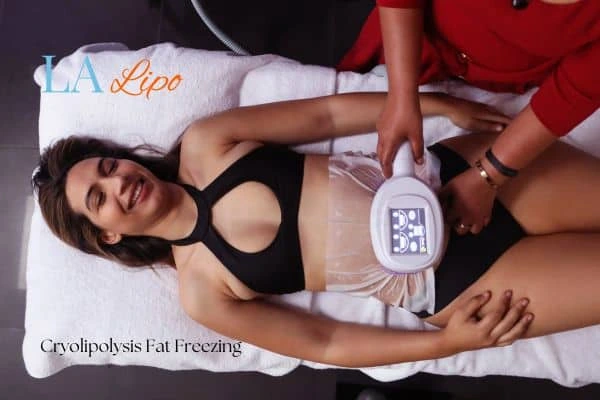 woman getting cryolipolysis Bradford-on-Avon