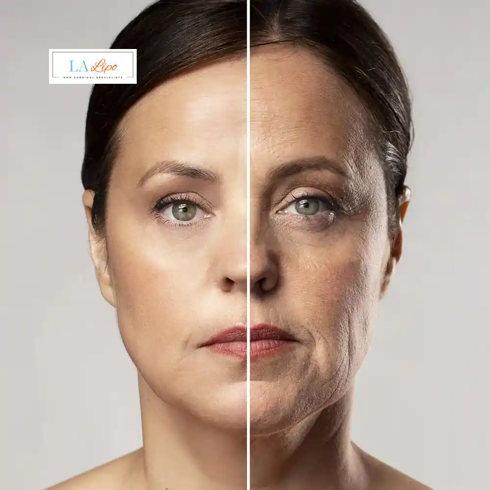 How Can You Tell If Non-Surgical Skin Tightening Is Right for You Bradford-on-Avon?