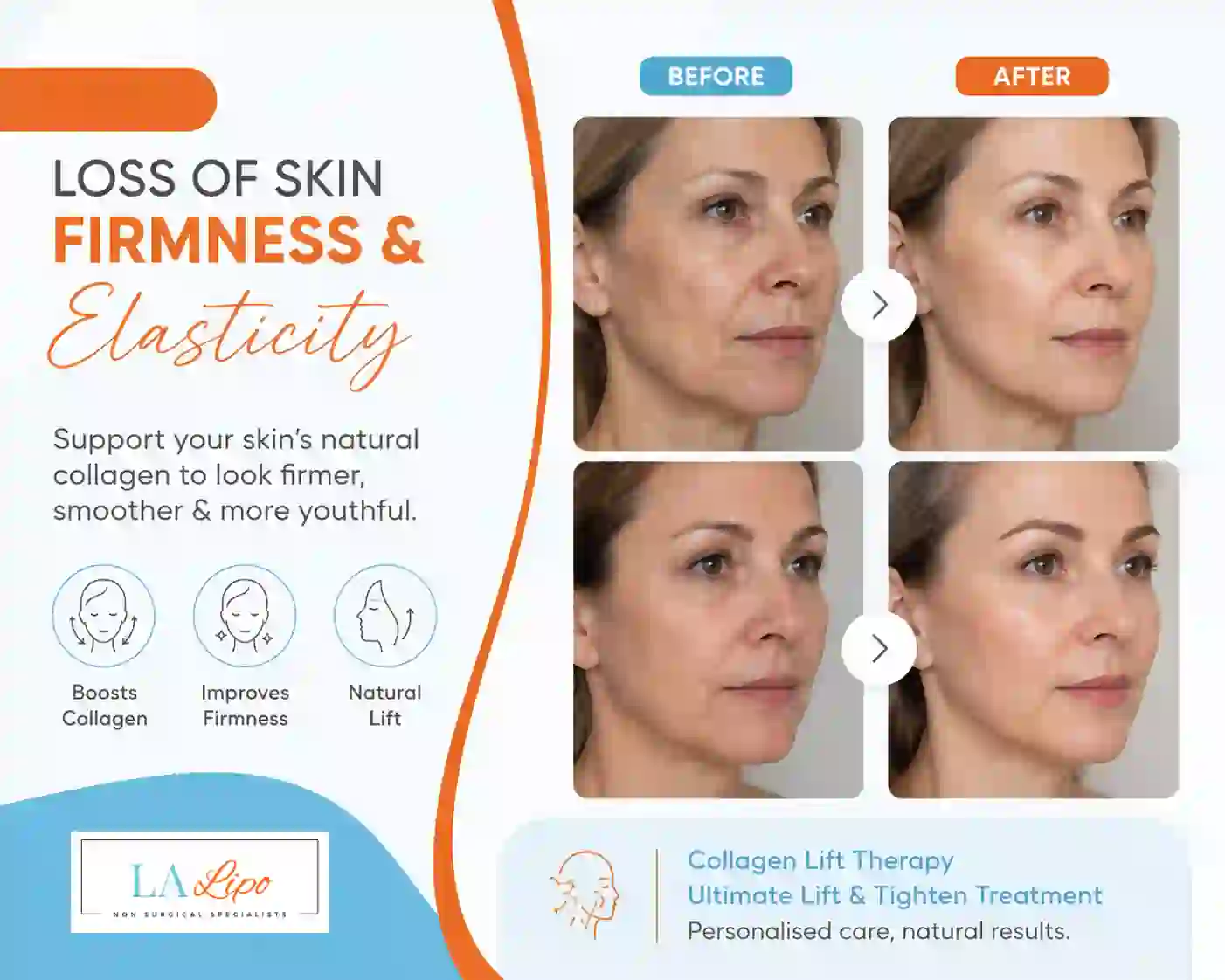 Sign #7: Loss of Skin Firmness and Elasticity Bradford-on-Avon