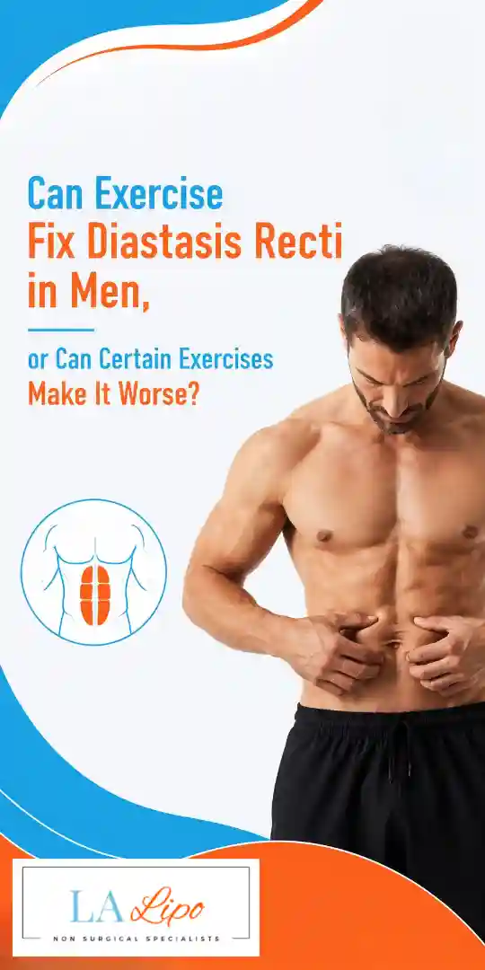 Can Exercise Fix Diastasis Recti in Men, or Can Certain Exercises Make It Worse Bradford-on-Avon?